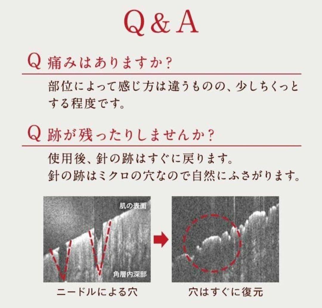 【当日発送】conc リンクルインジェクション　2本 セット