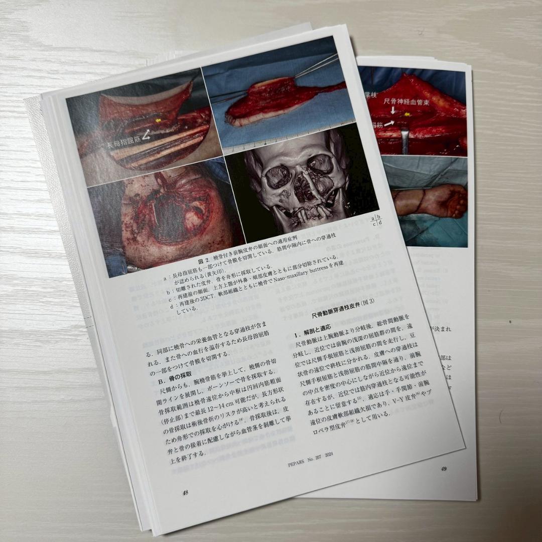 【裁断済】PEPARS　No.207　皮弁挙上に役立つ解剖
