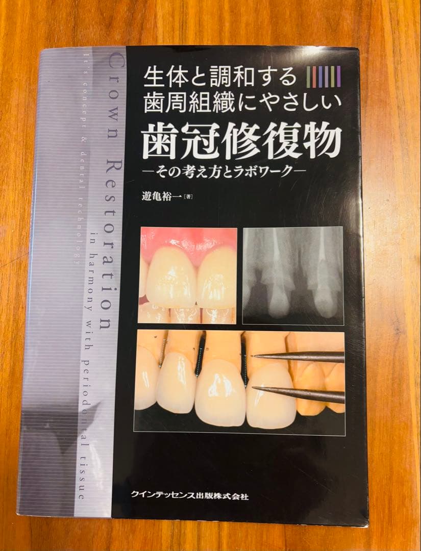 生体と調和する歯周組織にやさしい歯冠修復物