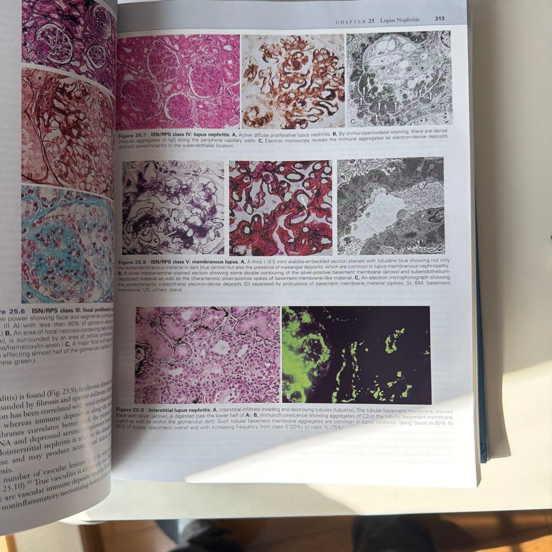 Comprehensive Clinical Nephrology 第四版