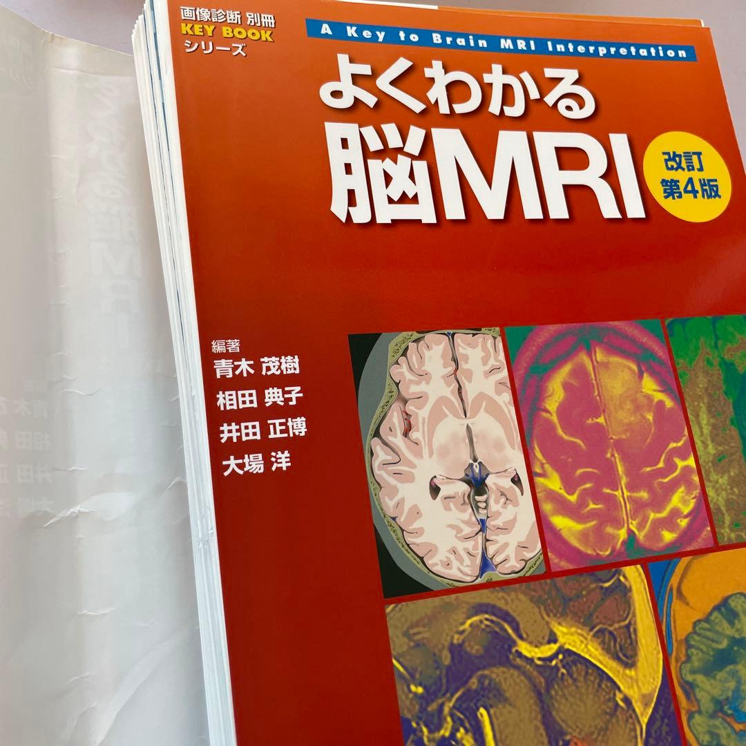 よくわかる脳MRI