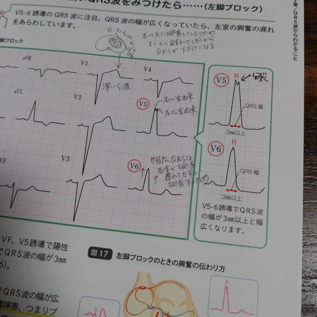 心電図検定　対策セット