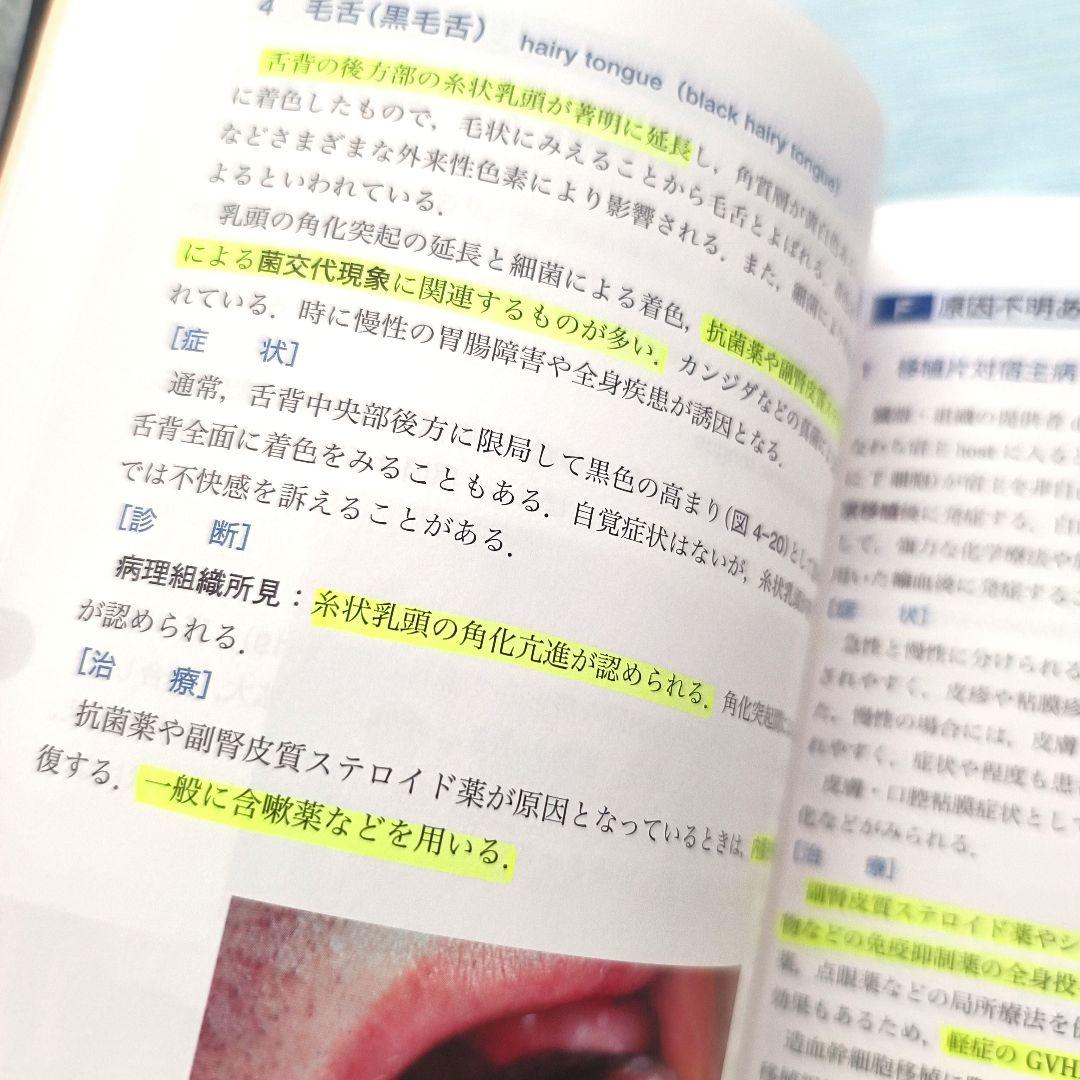 カラーアトラス　サクシンクト口腔外科学　第4版