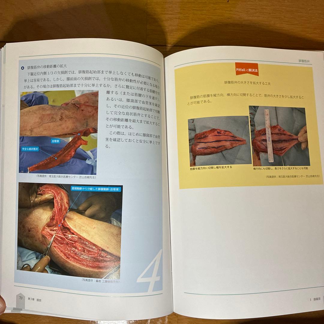 【値下げ中‼️】局所皮弁 1, 2, 3 セット