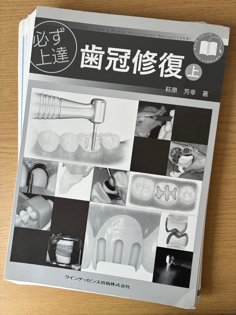 【裁断済】必ず上達歯冠修復 上下巻セット