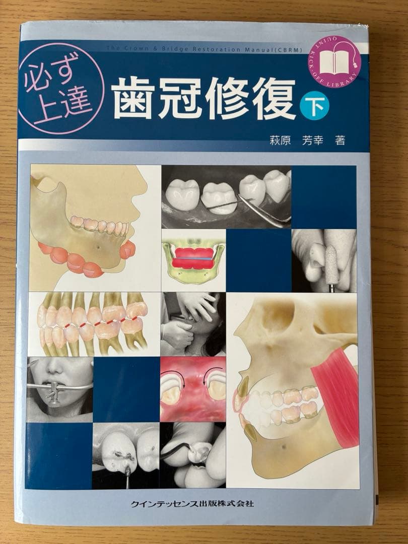 【裁断済】必ず上達歯冠修復 上下巻セット
