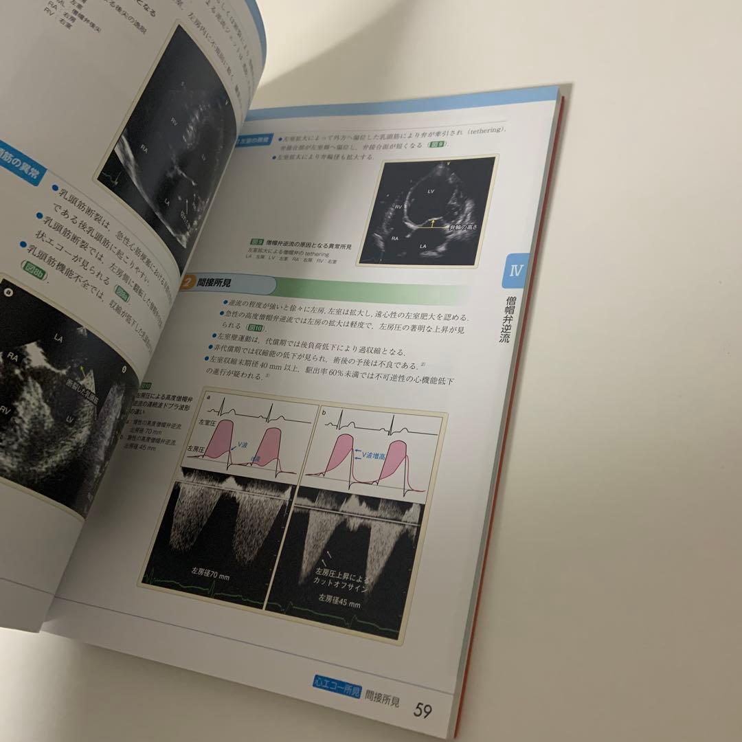 心エコーハンドブック心臓弁膜症