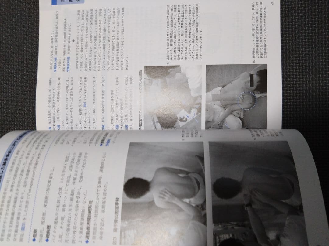 触診技術　整形外科運動療法ナビゲーション 上肢　理学療法士　作業療法士　国家試験