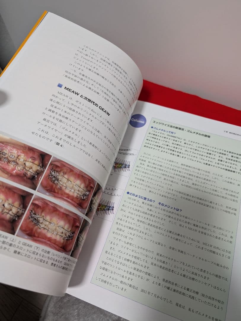 あなたもスーパー矯正ドクター 菊池武芳 本 歯科