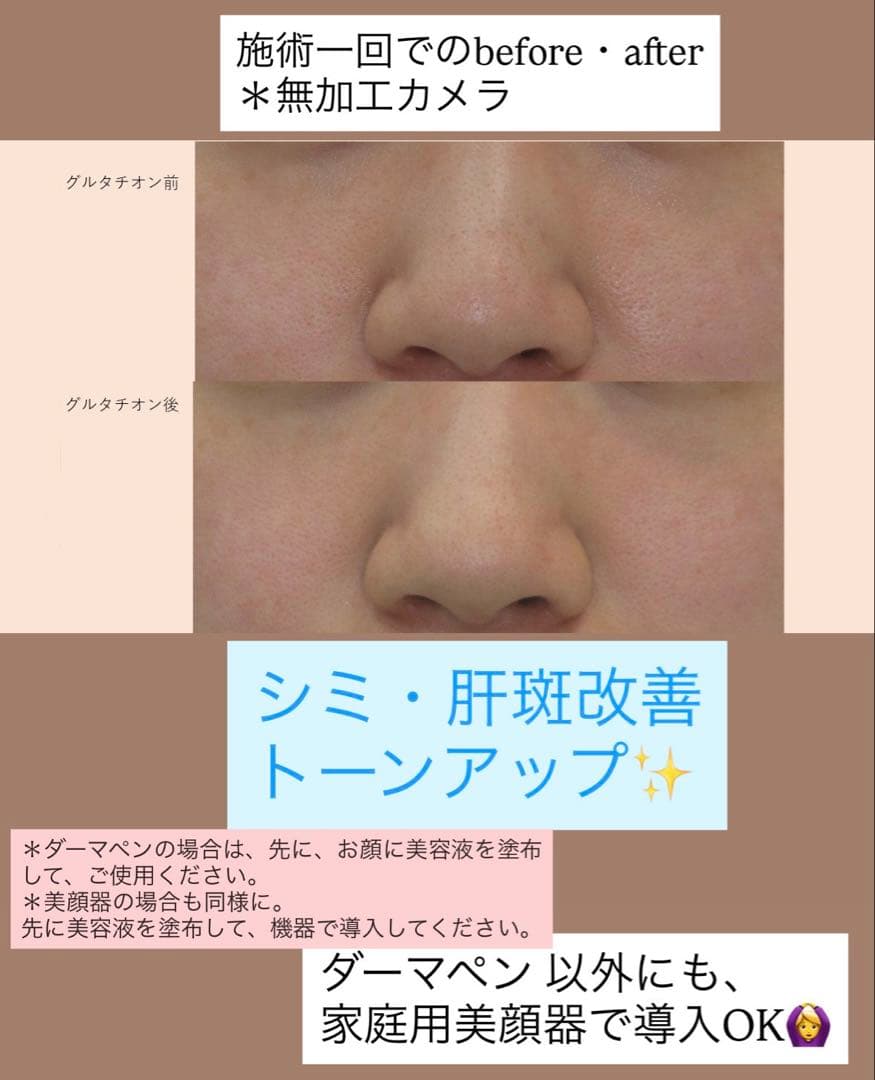 ミッヒィ　高純度リジュラン、グルタチオンStem Cell ブースター