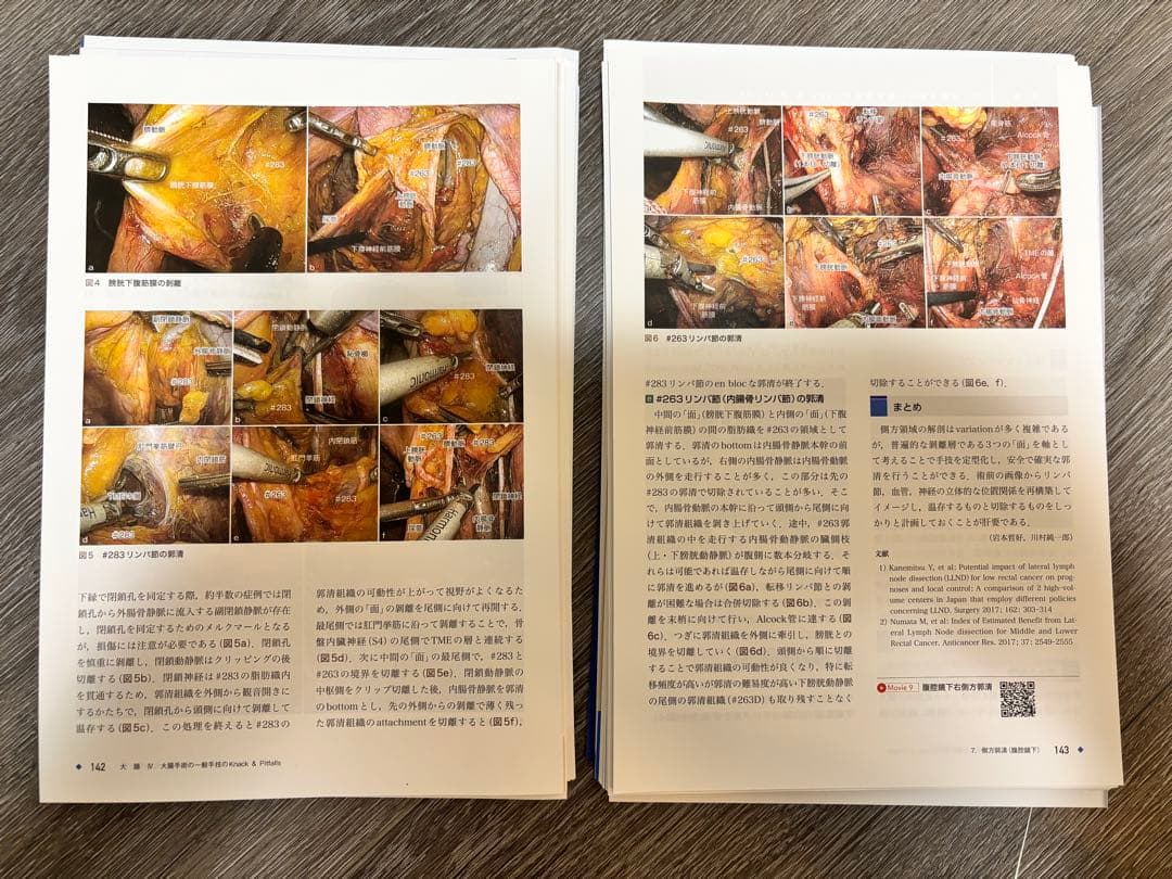 【裁断済み】大腸・肛門外科の要点と盲点