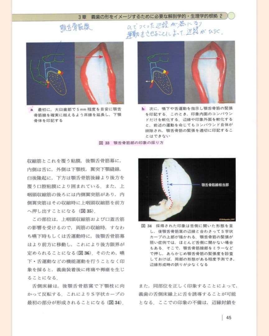 【裁断済】【即日発送】総義歯臨床の押さえどころ