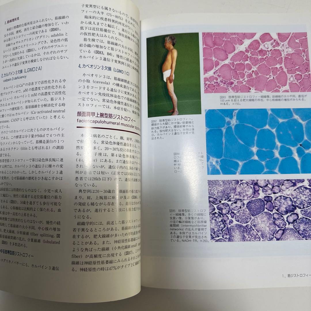 臨床のための筋病理