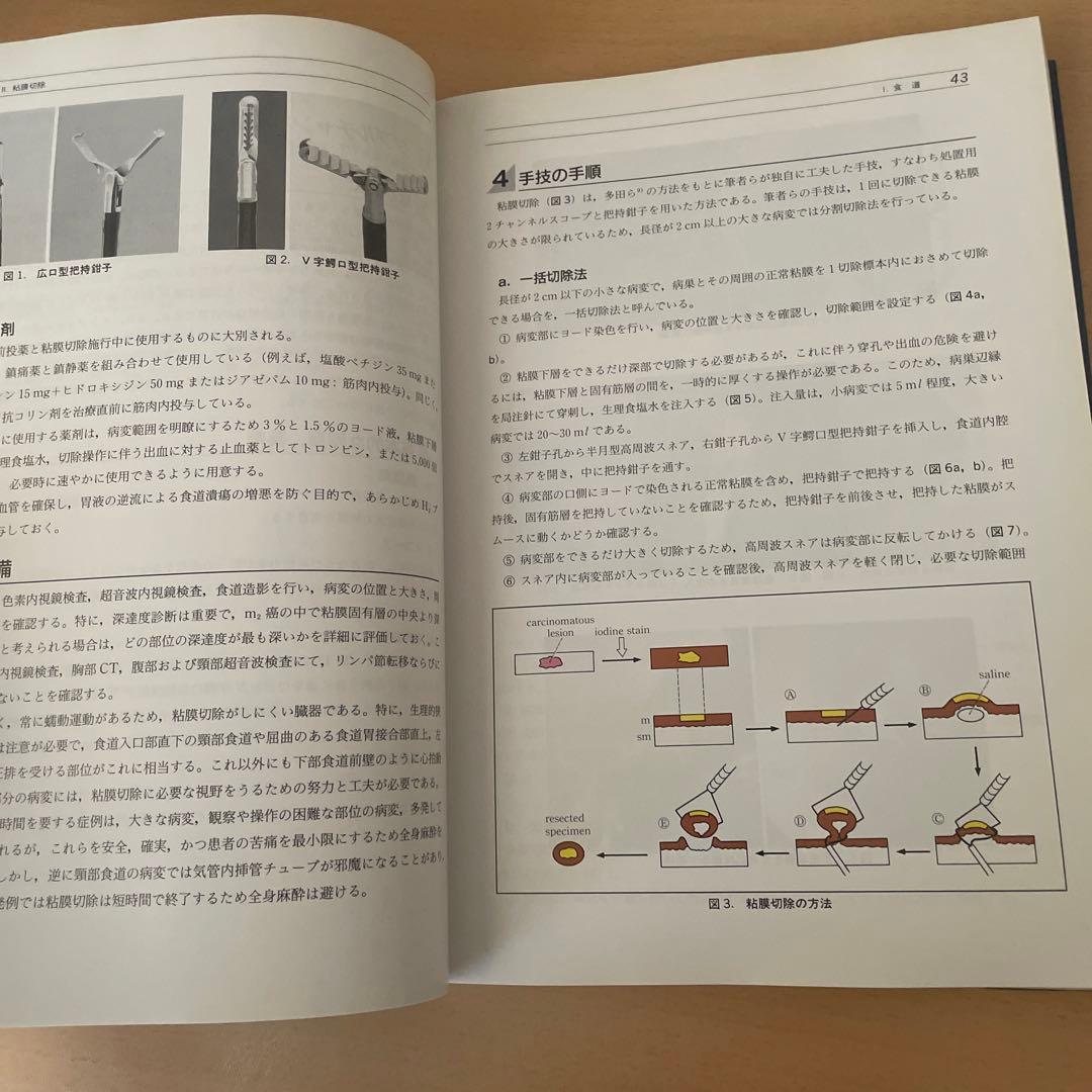 消化器治療内視鏡の基本手技