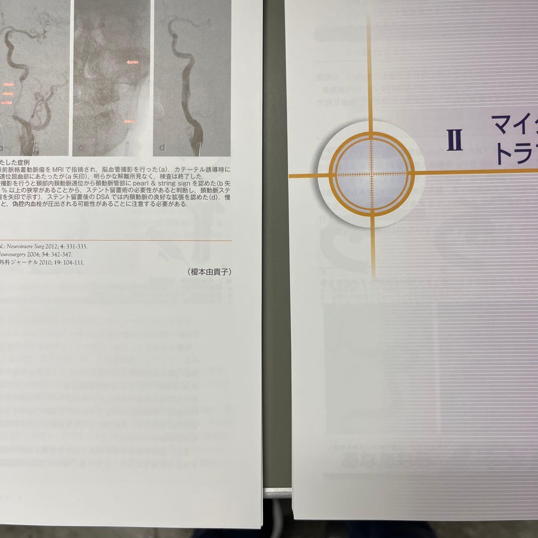 【裁断済み】脳血管内治療トラブルシューティング 脳動脈瘤編 改訂第2版