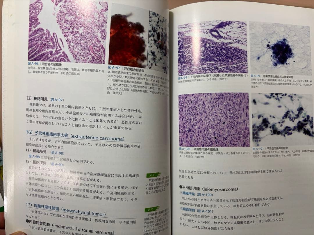 スタンダード細胞診テキスト 第4版 病理 病理検査 臨床検査