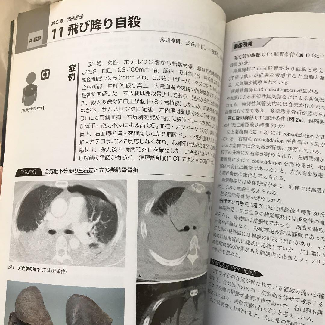 オートプシー・イメージング読影ガイド