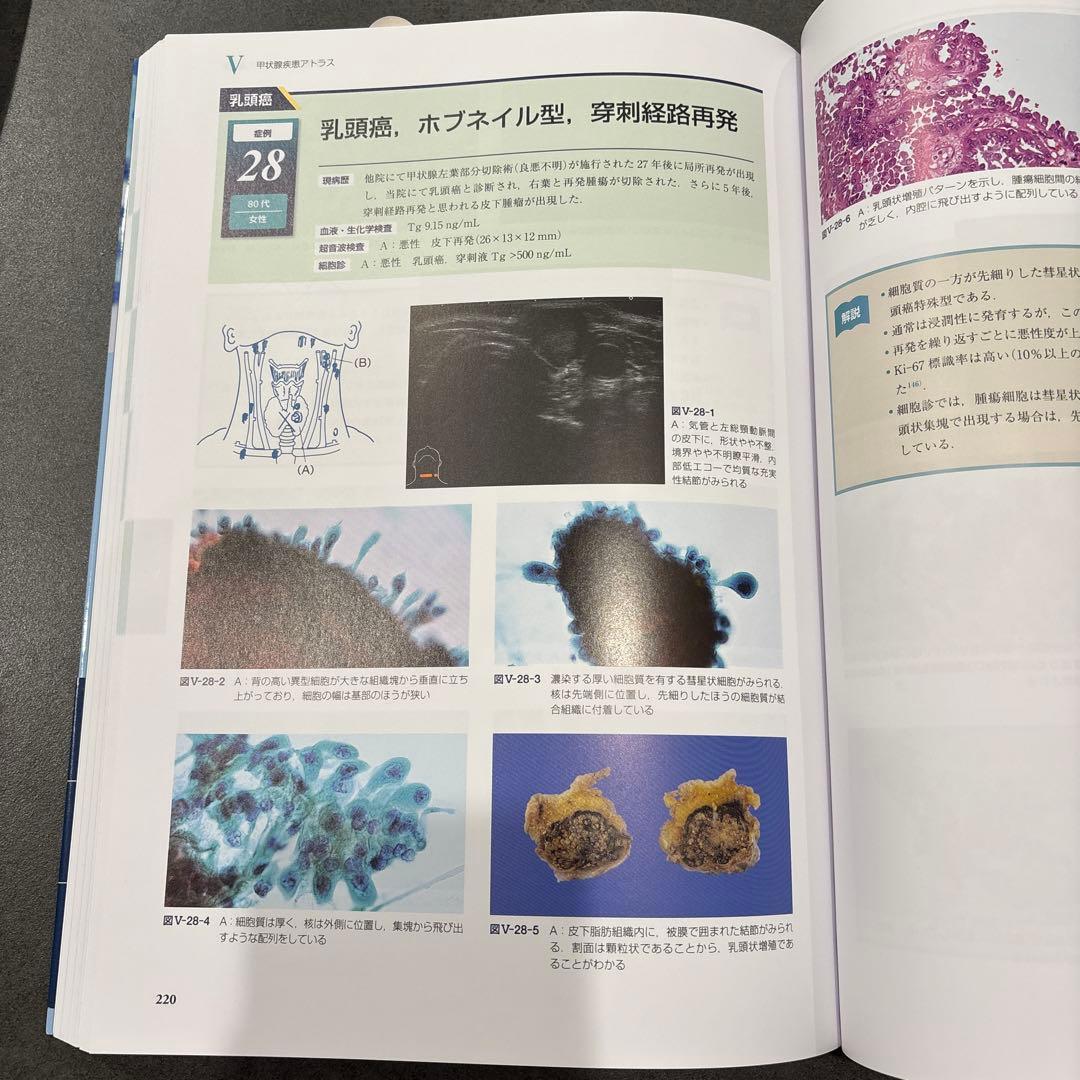 甲状腺疾患診断　アトラス