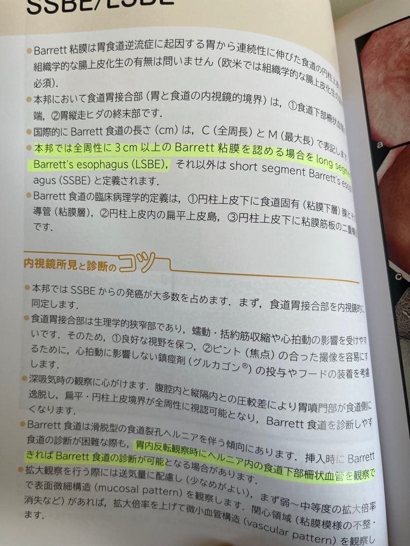 上部と下部消化管内視鏡診断アトラスのセットです！