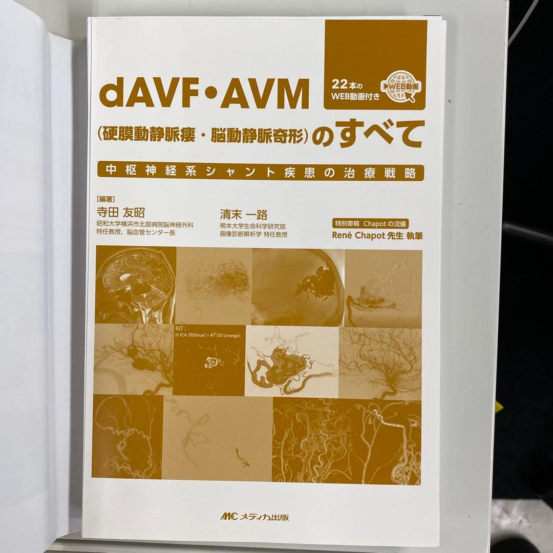 dAVF・AVM(硬膜動静脈瘻・脳動静脈奇形)のすべて : 中枢神経系シャント…