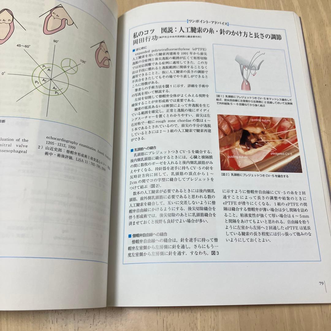Knack & Pitfalls 弁膜症外科の要点と言点