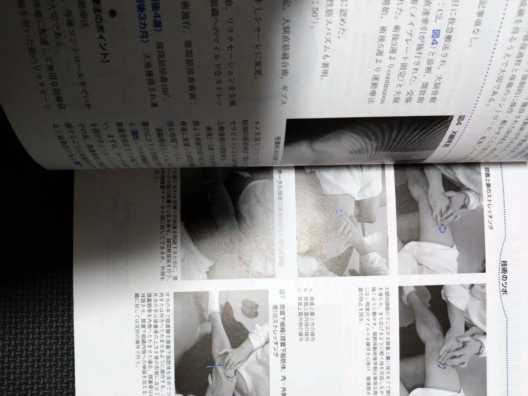 整形外科運動療法ナビゲーション　関節機能解剖学に基づく 下肢体幹　理学療法　PT