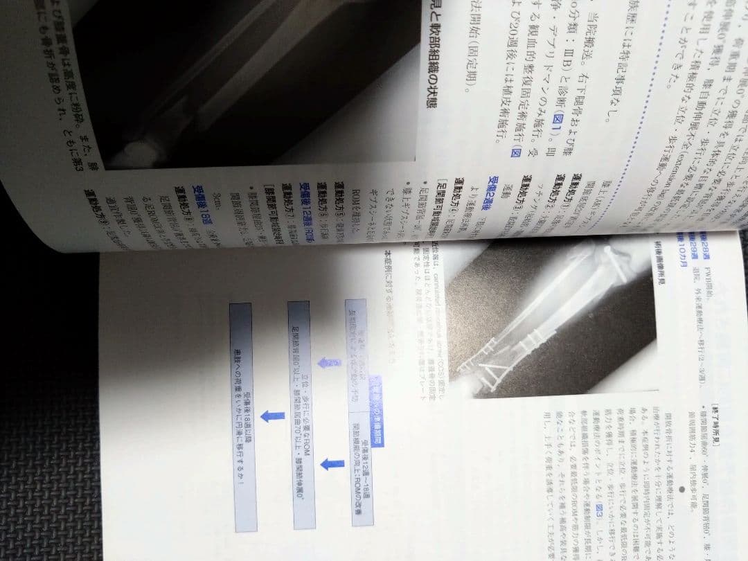 整形外科運動療法ナビゲーション　関節機能解剖学に基づく 下肢体幹　理学療法　PT