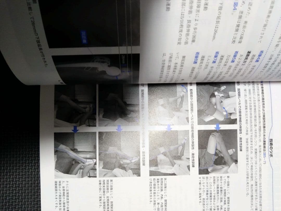整形外科運動療法ナビゲーション　関節機能解剖学に基づく 下肢体幹　理学療法　PT