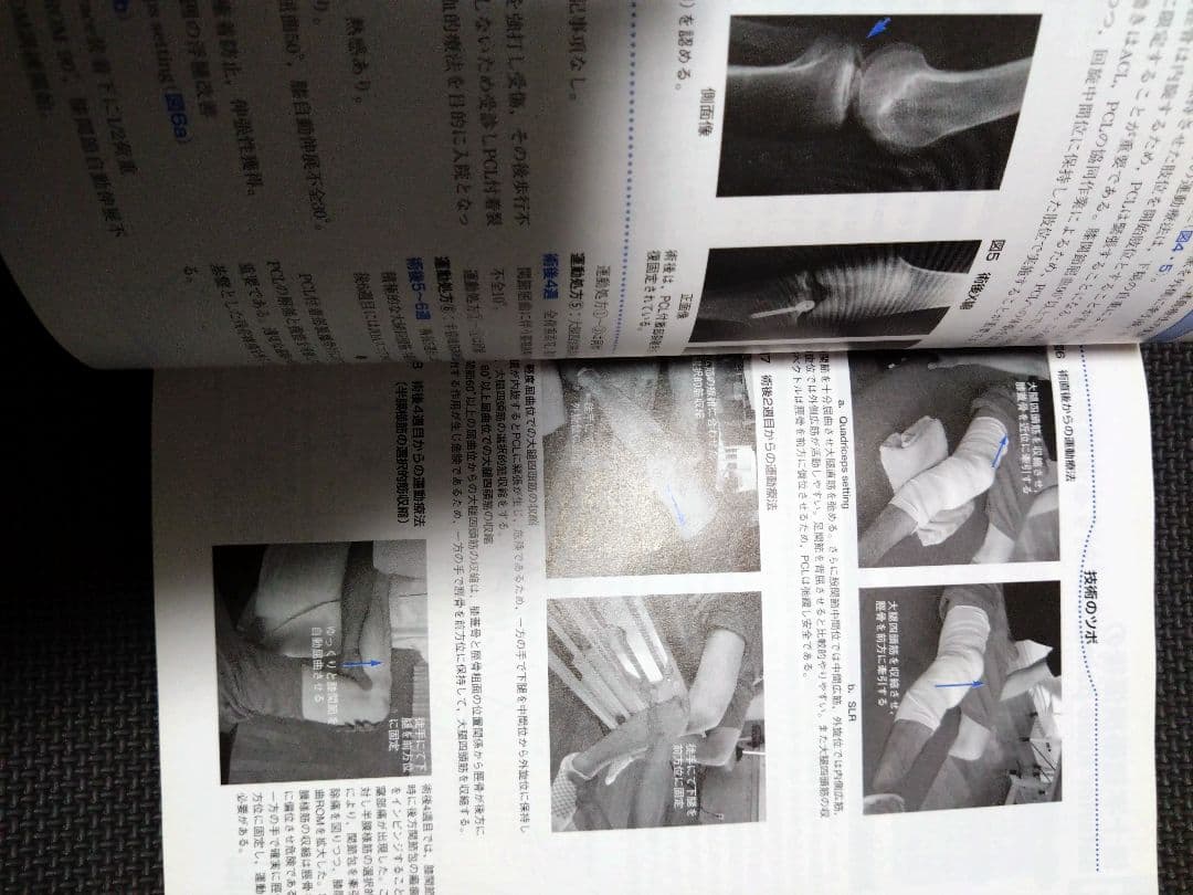 整形外科運動療法ナビゲーション　関節機能解剖学に基づく 下肢体幹　理学療法　PT