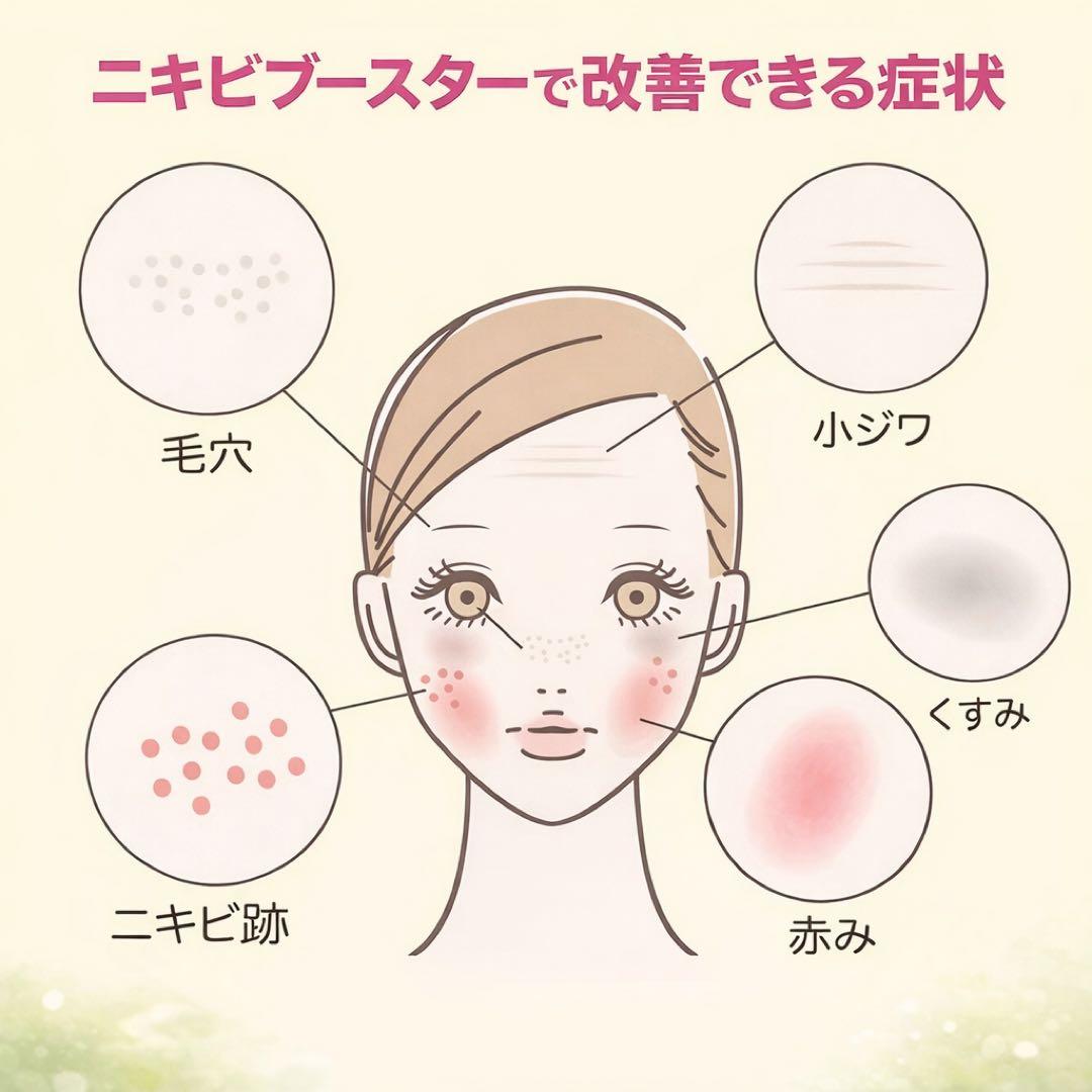 YOU　ニキビブースターAC Stem Cell 、ダーマローラー