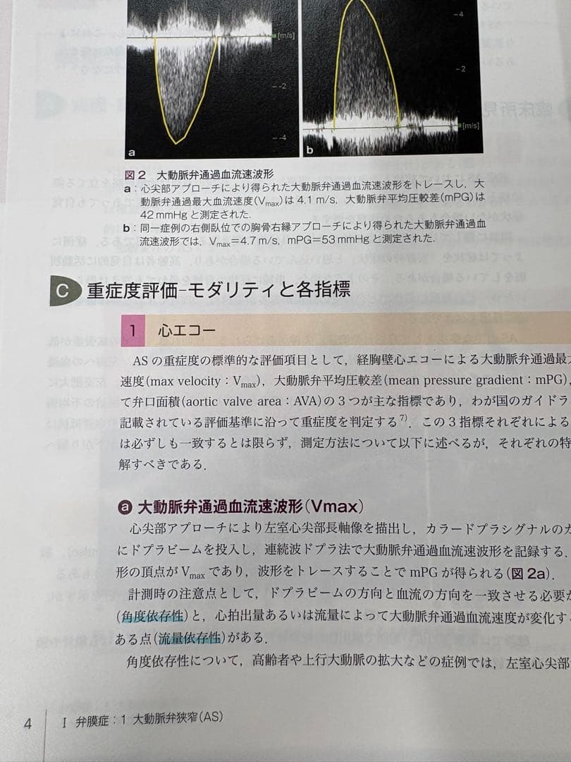 （裁断済）SHDインターベンションコンプリートガイド