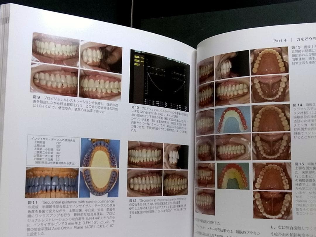 補綴臨床別冊 歯列を守る力のマネジメント 力を診る