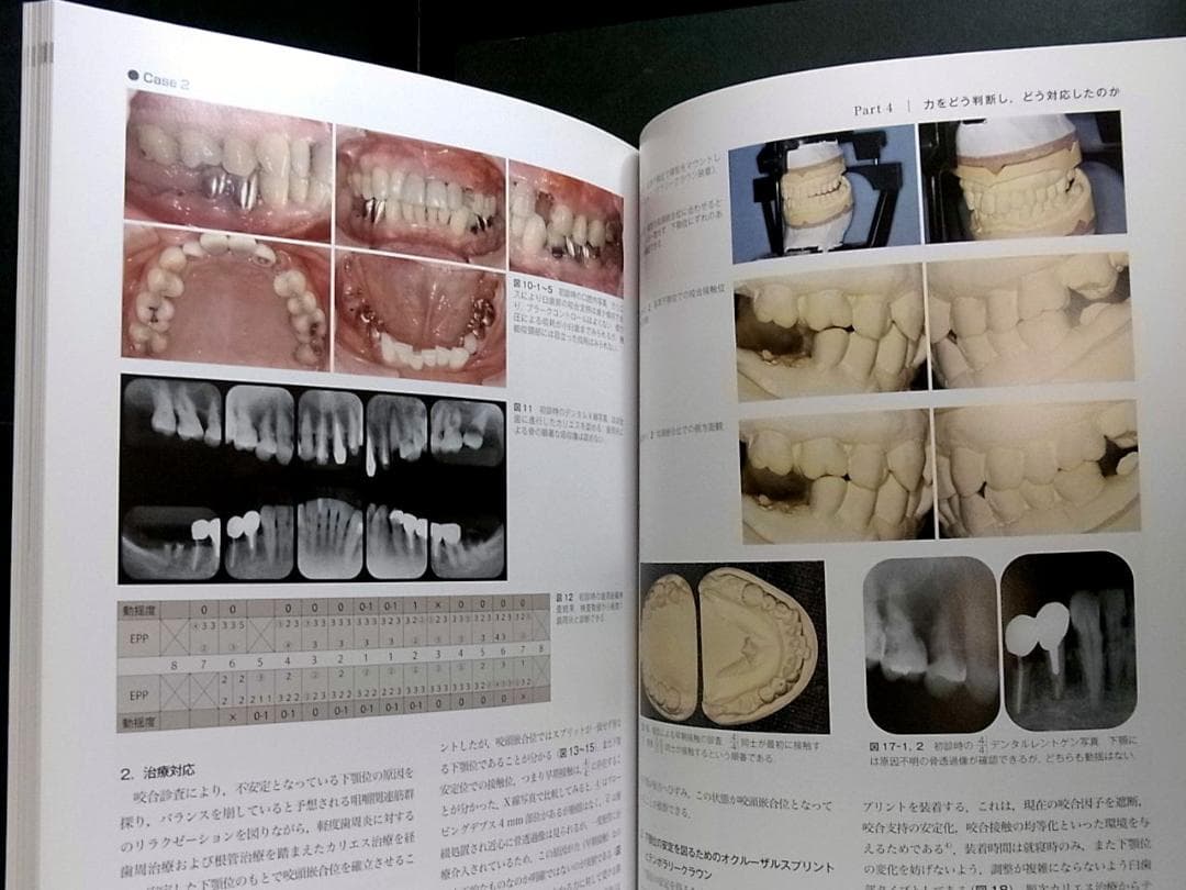 補綴臨床別冊 歯列を守る力のマネジメント 力を診る