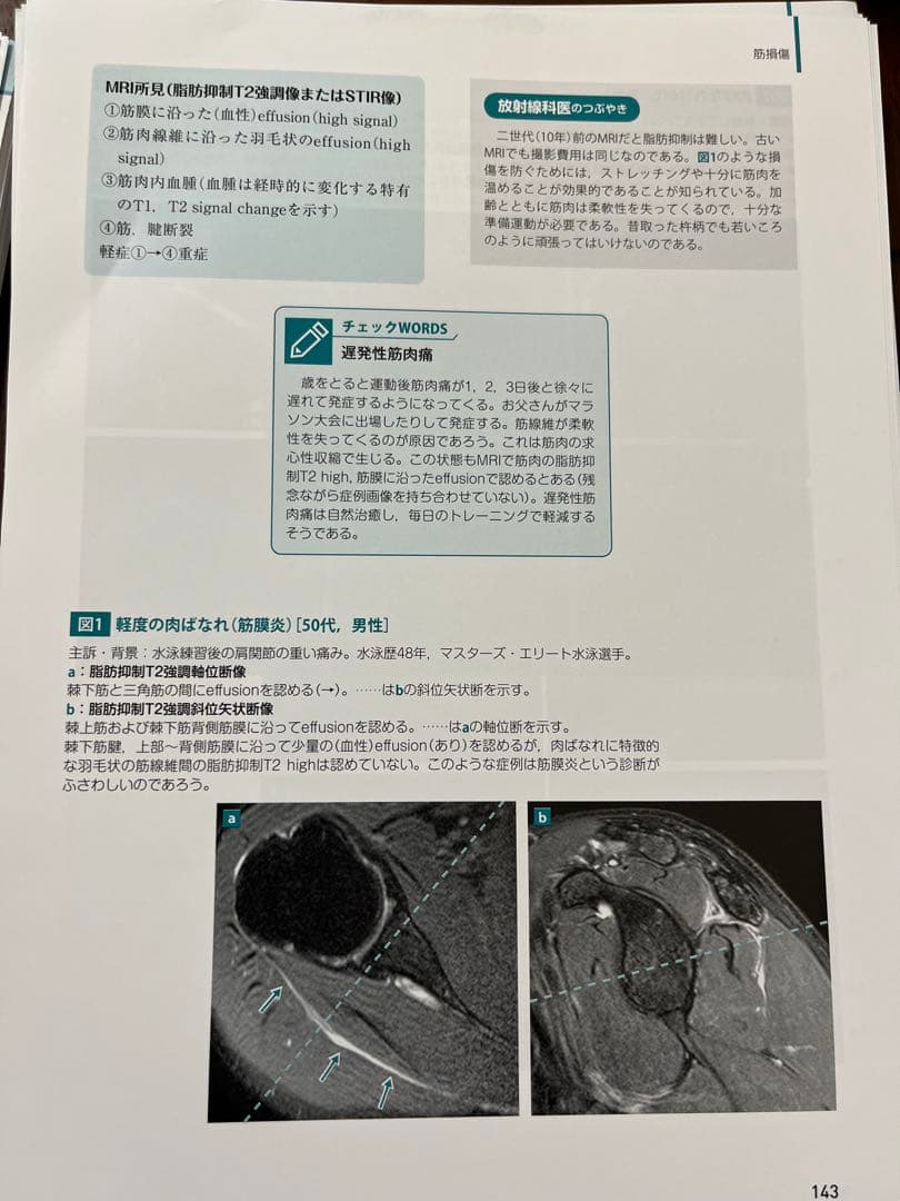 【裁断済】肩関節のMRI 読影ポイントと新しい知見　第3版