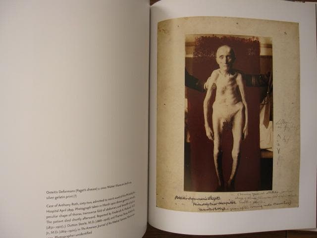 Mutter Museum： Of the College