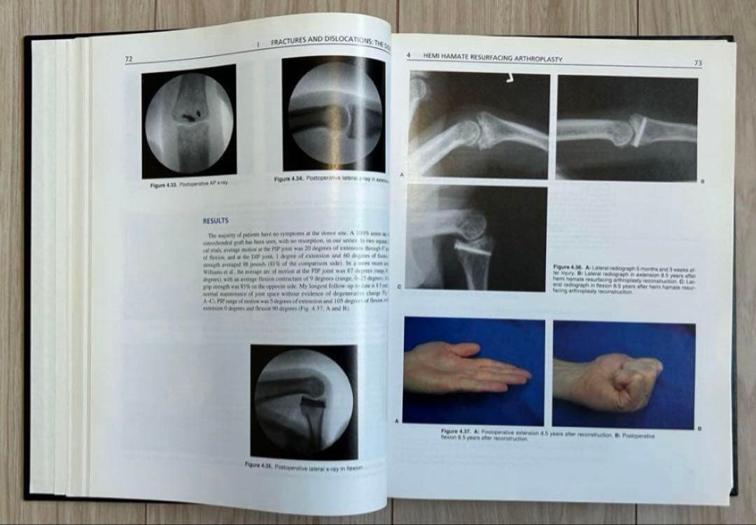 THE HAND Second Edition 医学書　洋書　外科