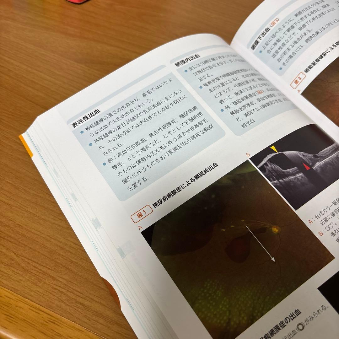 新 眼科診察クローズアップ