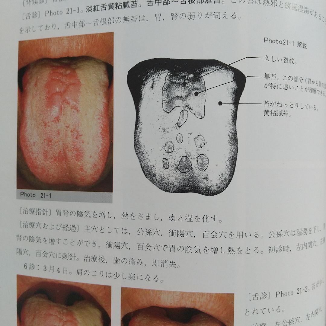 針灸舌診アトラス - 診断基礎と臨床の実際★藤本蓮風
