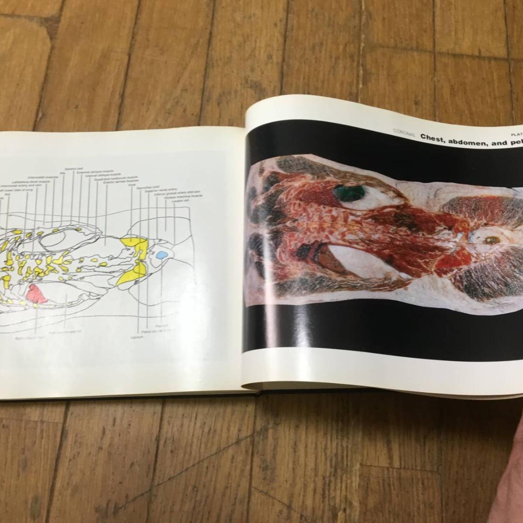 A color atlas of sectional anatomy医学洋書大型