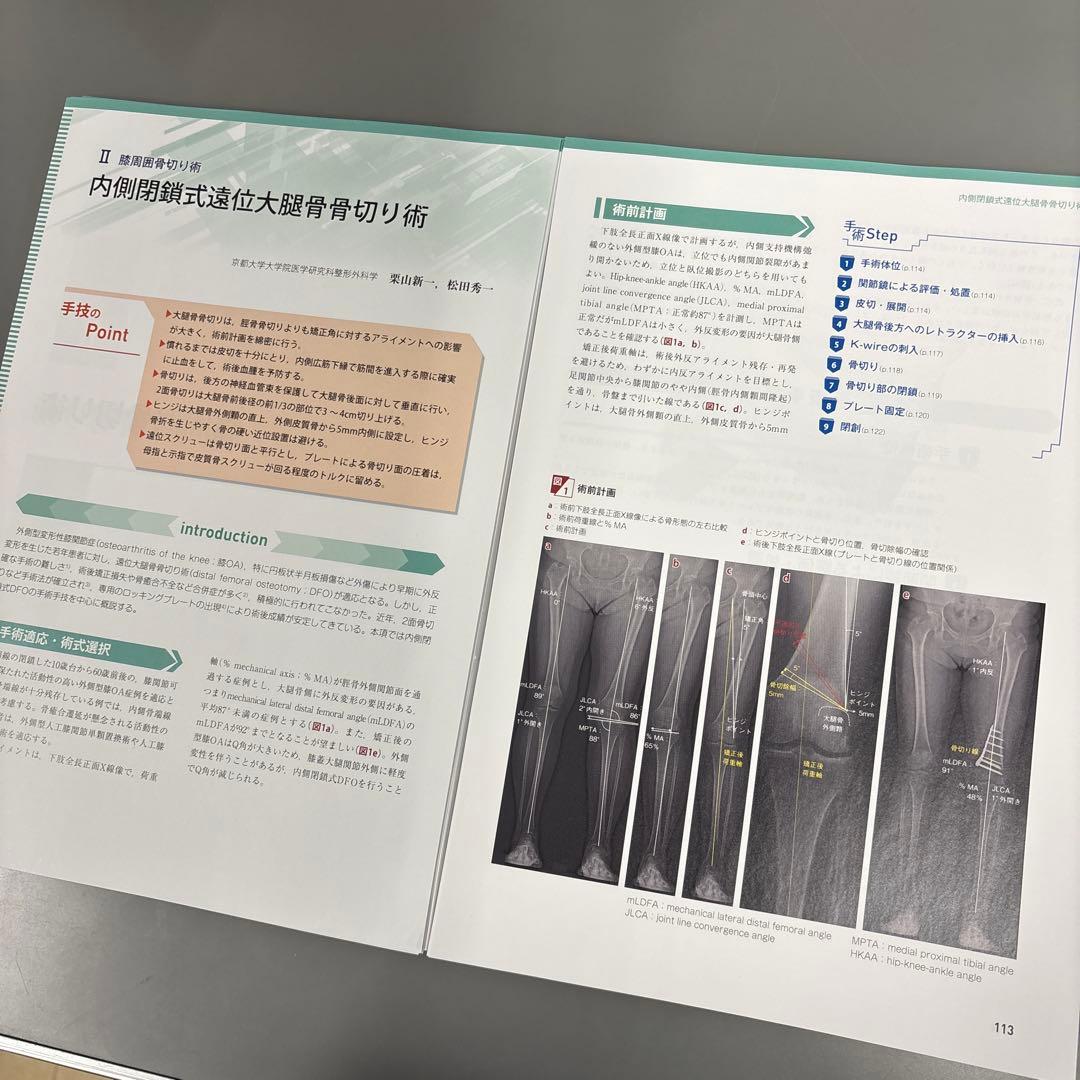 【裁断】新OS NEXUS 膝関節の再建手術