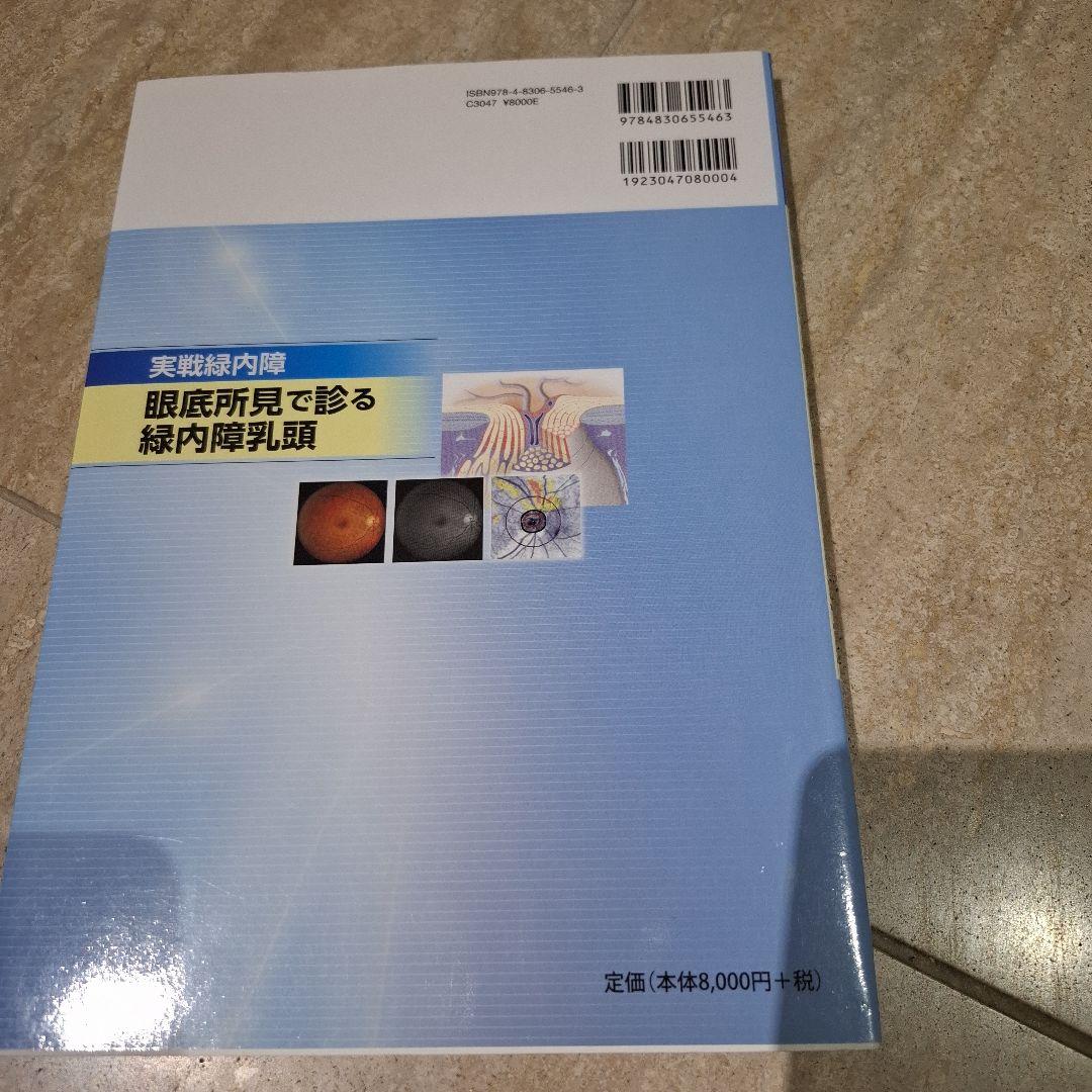 実戦緑内障 眼底所見で診る緑内障乳頭