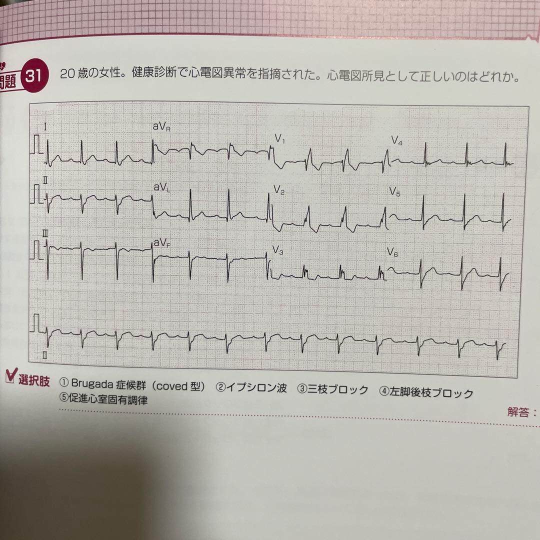 【看護師・看護学生むけ】心電図関連書籍5冊セット