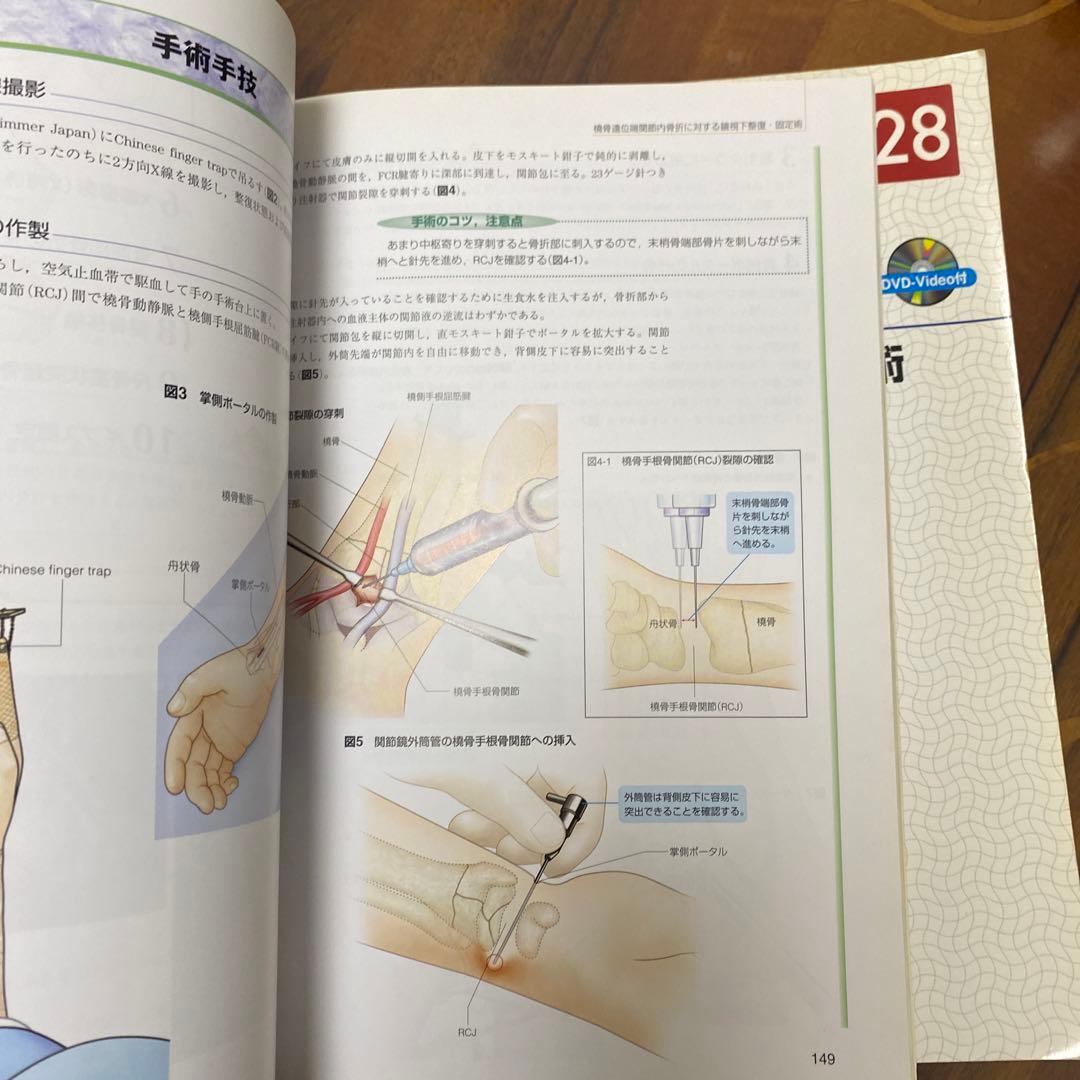 上肢の骨折・脱臼 : 手技のコツ&トラブルシューティング
