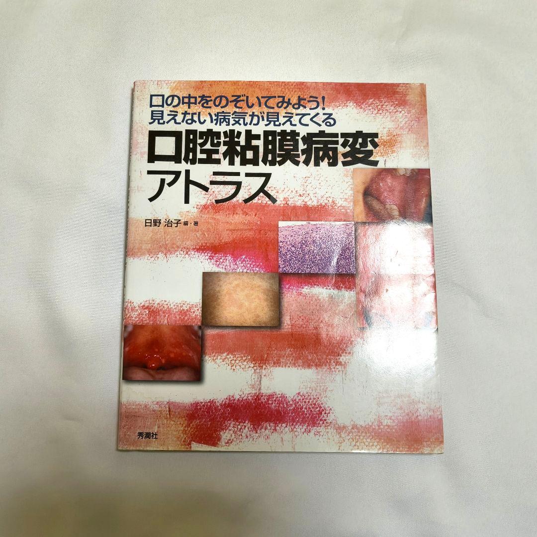 口腔粘膜病変アトラス