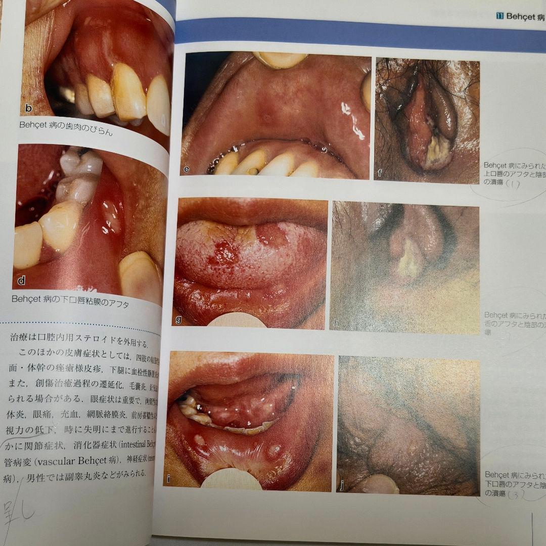 口腔粘膜病変アトラス