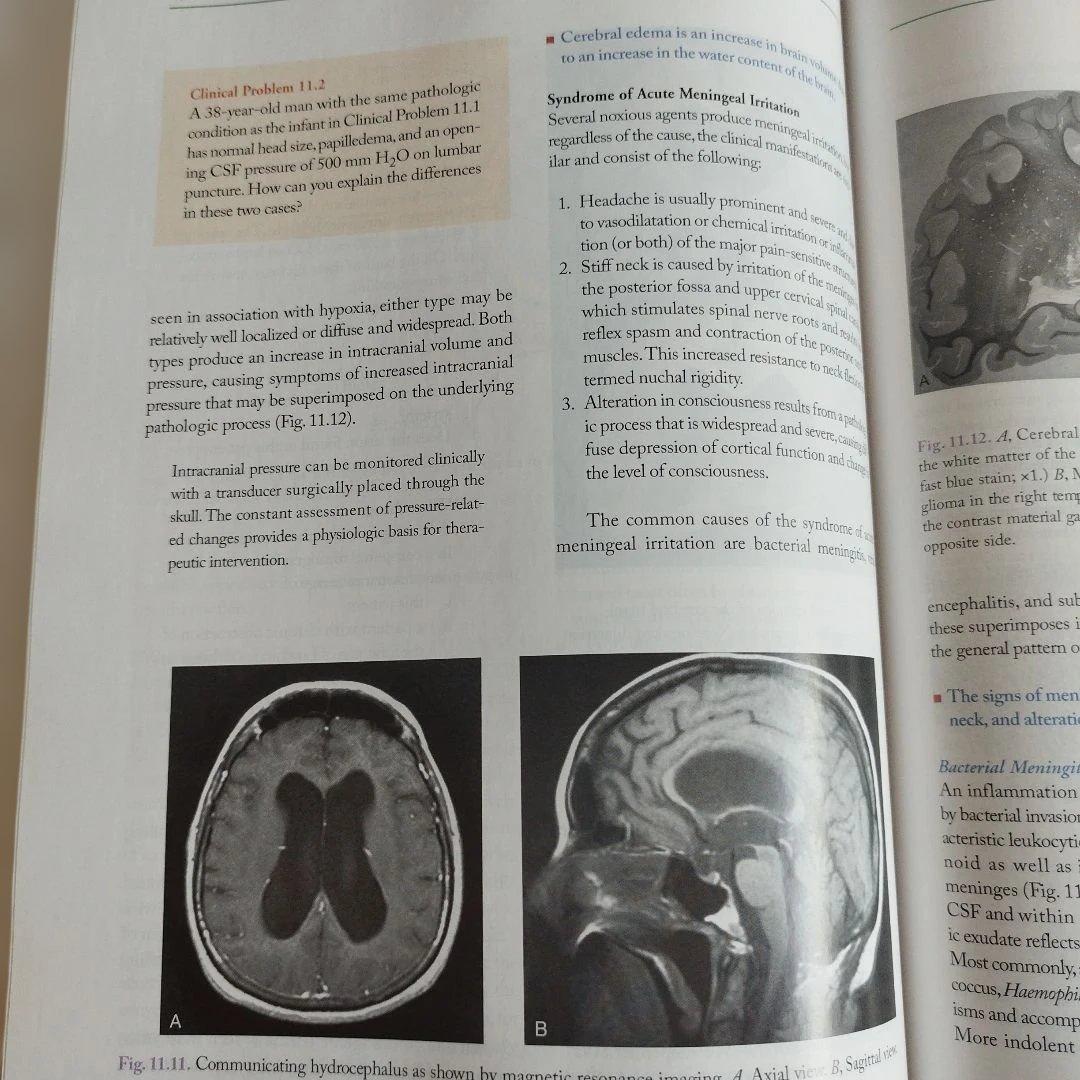 MayoClinic　Medical Neurosciences メイヨークリニ